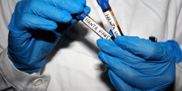 All Your Hantavirus Questions, Answered by an Infectious Disease Expert
