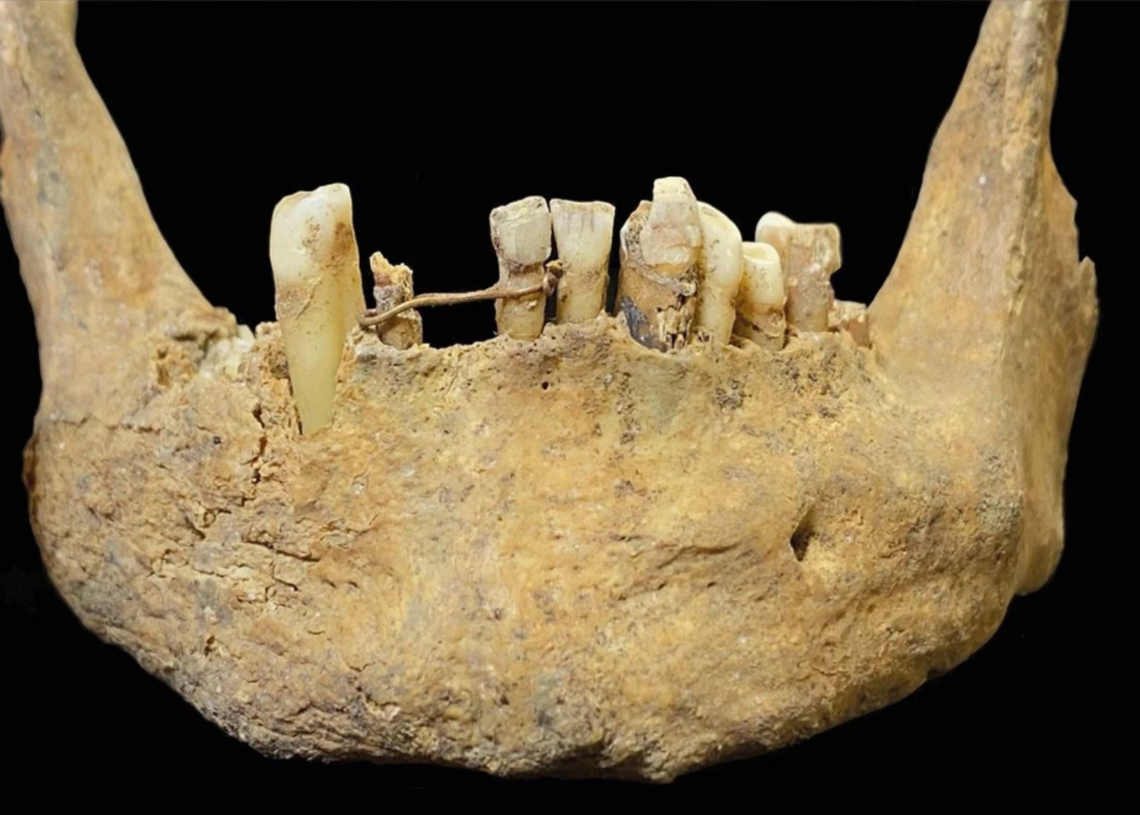 Archaeologists Found a Medieval Skeleton With Something Strange in Its Jaws