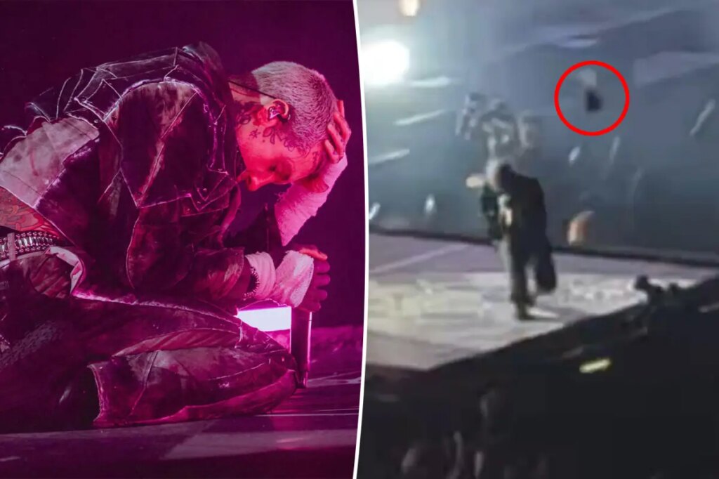 Bring Me the Horizon frontman Oli Sykes suffers concussion after fan throws phone at his head during concert