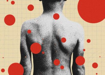 The Backward Logic of Chickenpox Parties