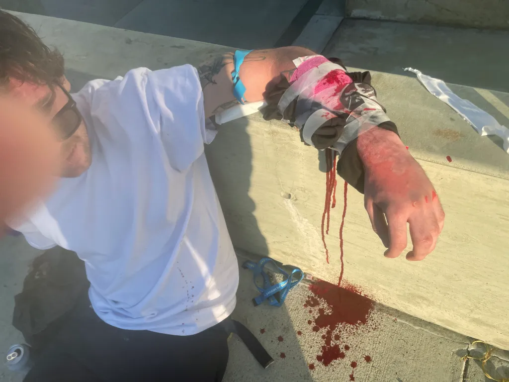 A person with a bandaged, bloodied arm lying on concrete after a samurai sword attack.