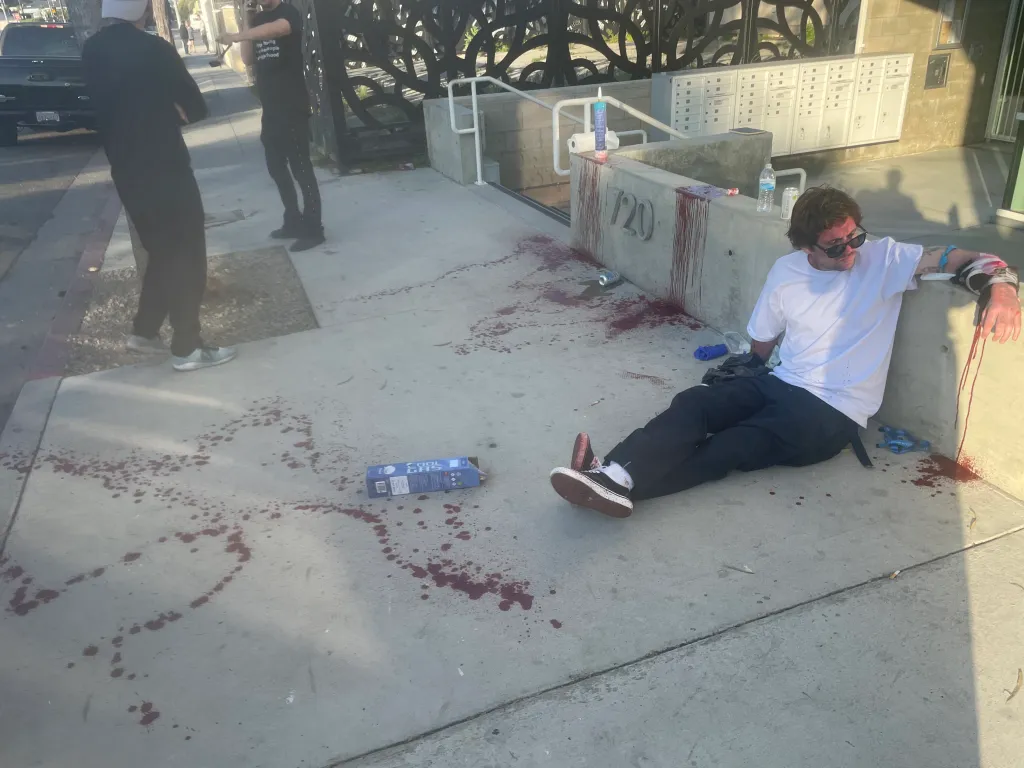 A man with a bandaged, bloody arm sits on a sidewalk next to a blood-spattered wall, with bloodstains on the pavement around him, showing the aftermath of a samurai sword attack in Venice.