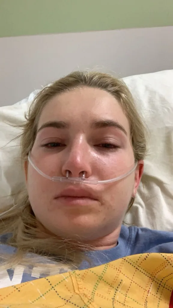 Caroline Cray with a nasal cannula in her nose looks toward the camera with red, swollen eyes, illustrating autoimmune disease.