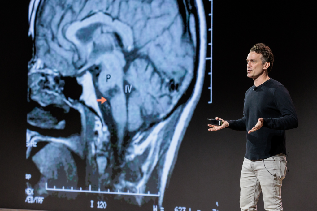 Tom Oxley presenting on stage next to a brain scan image with a lesion highlighted by an orange arrow.