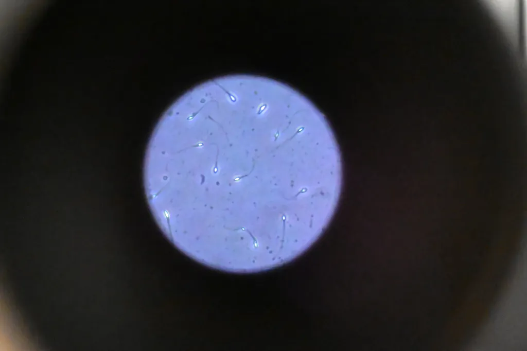 Microscopic view of numerous active sperm cells.