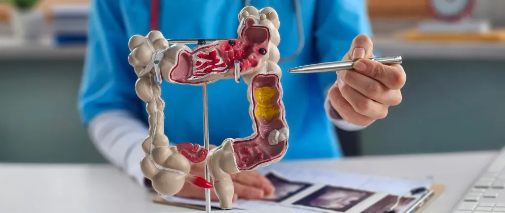 The ACS recommends blood-based testing and at-home stool sampling as options for colorectal cancer screening.