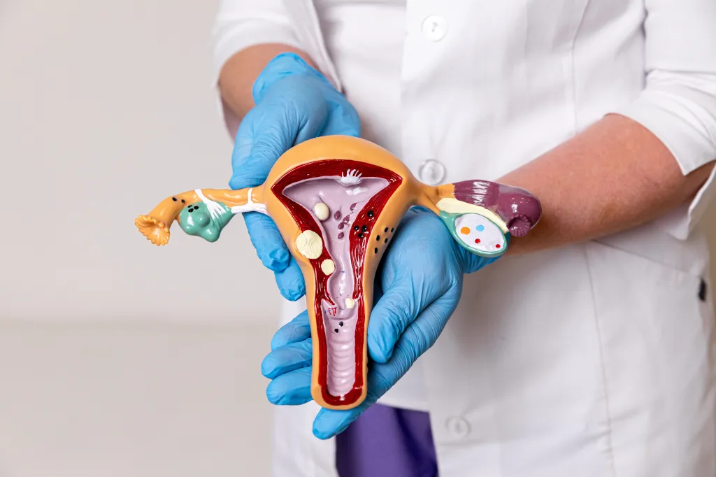 A doctor holding a uterus and ovaries model showing uterine fibroids, ovarian cysts, and other pathologies.
