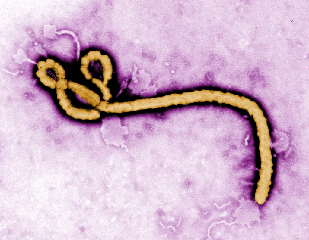 Colorized transmission electron micrograph of an Ebola virus virion.