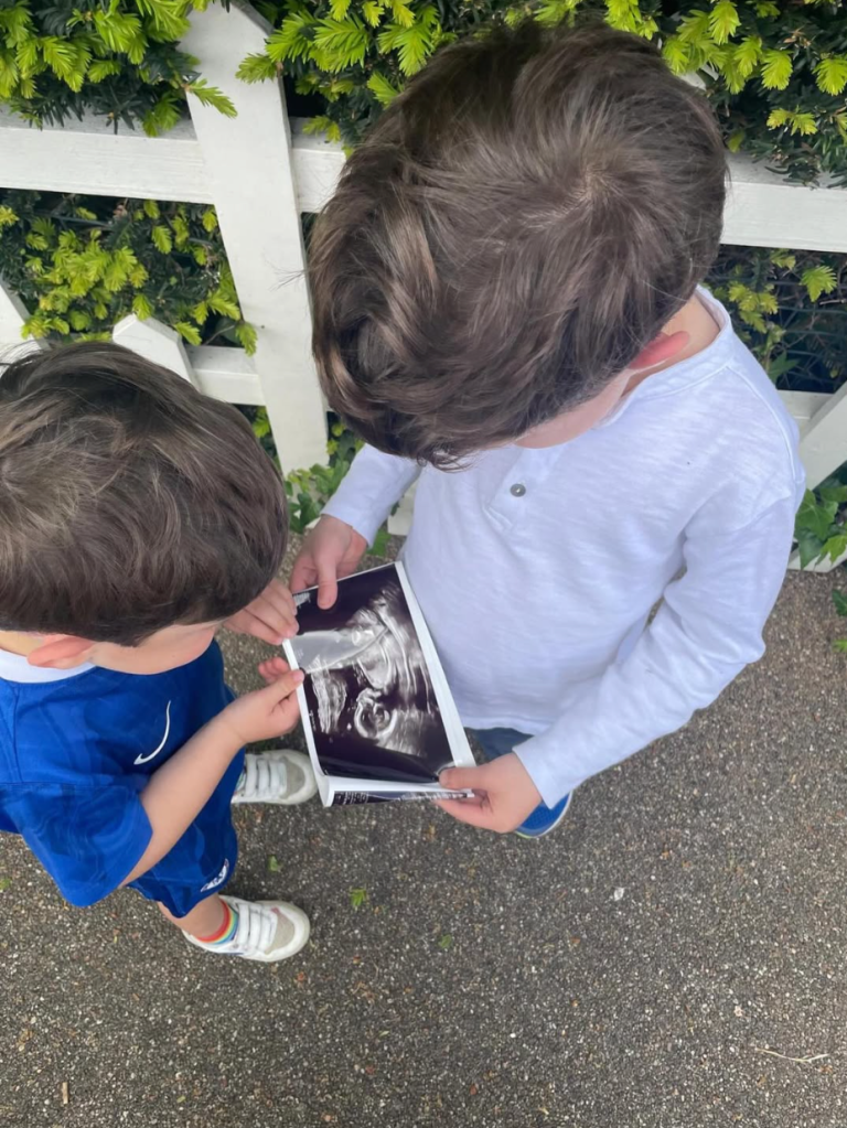 Two young boys looking at a sonogram.