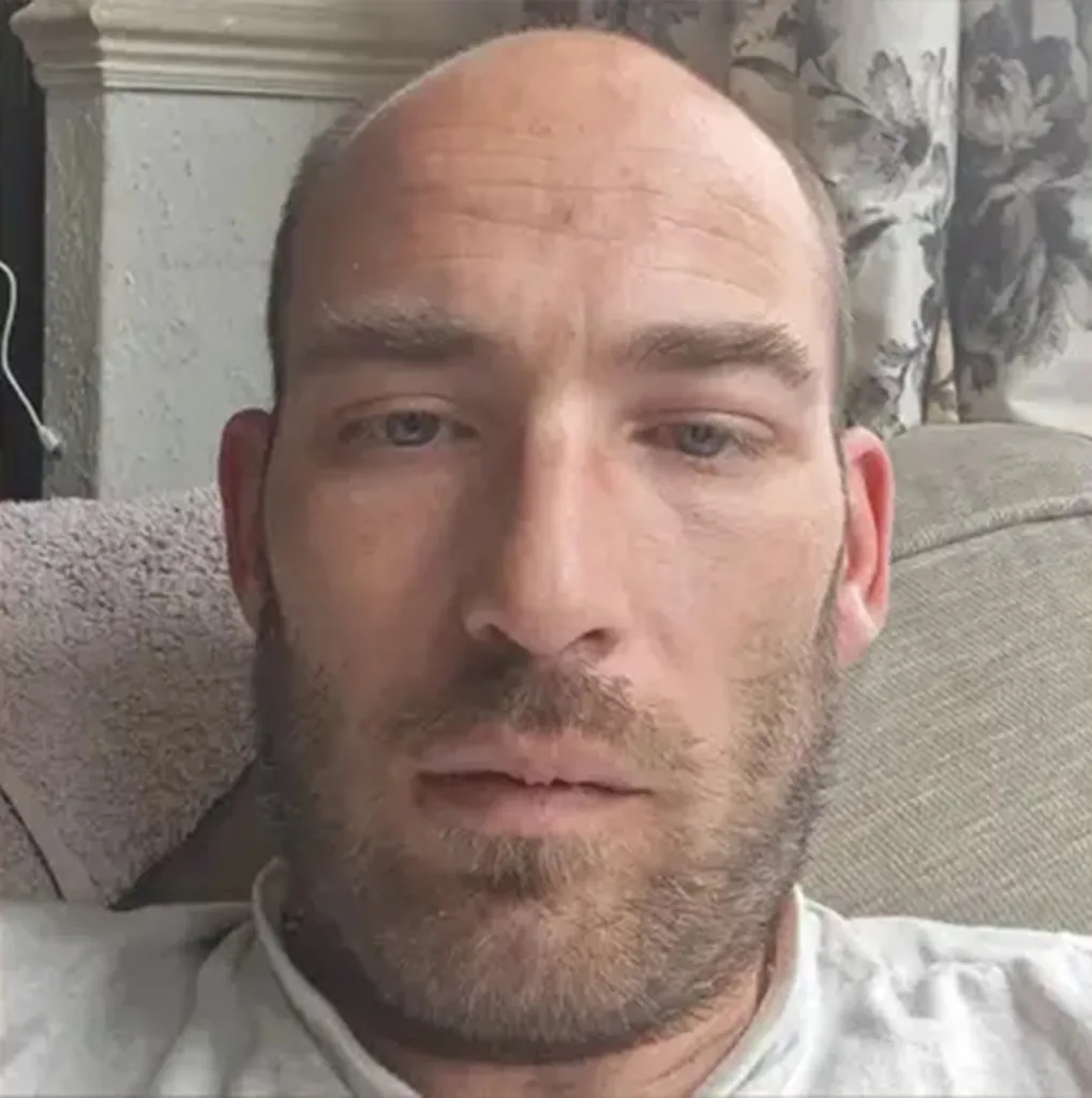 Close-up of Gary Macarthur, a bald man with light stubble and tired eyes.