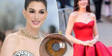 Anne Hathaway’s secret decade-long medical condition left her nearly blind throughout her 30s
