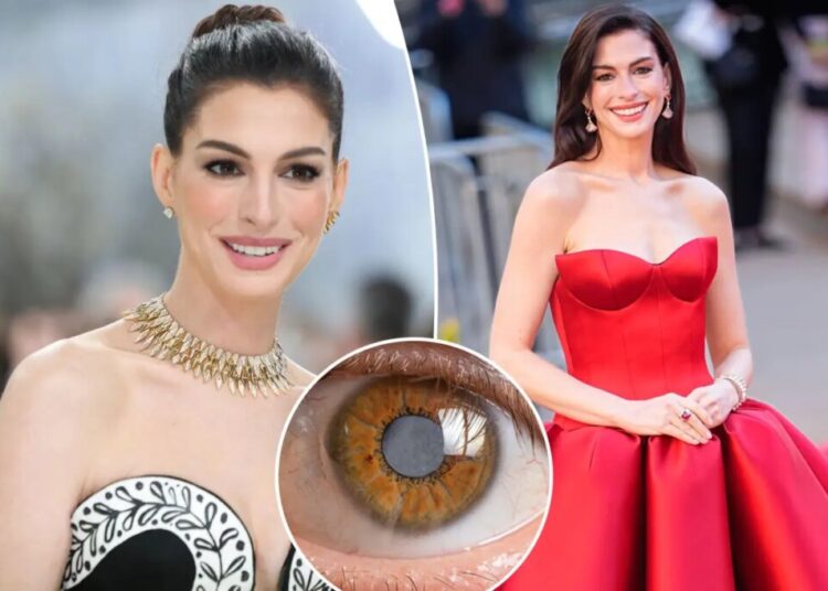 Anne Hathaway’s secret decade-long medical condition left her nearly blind throughout her 30s