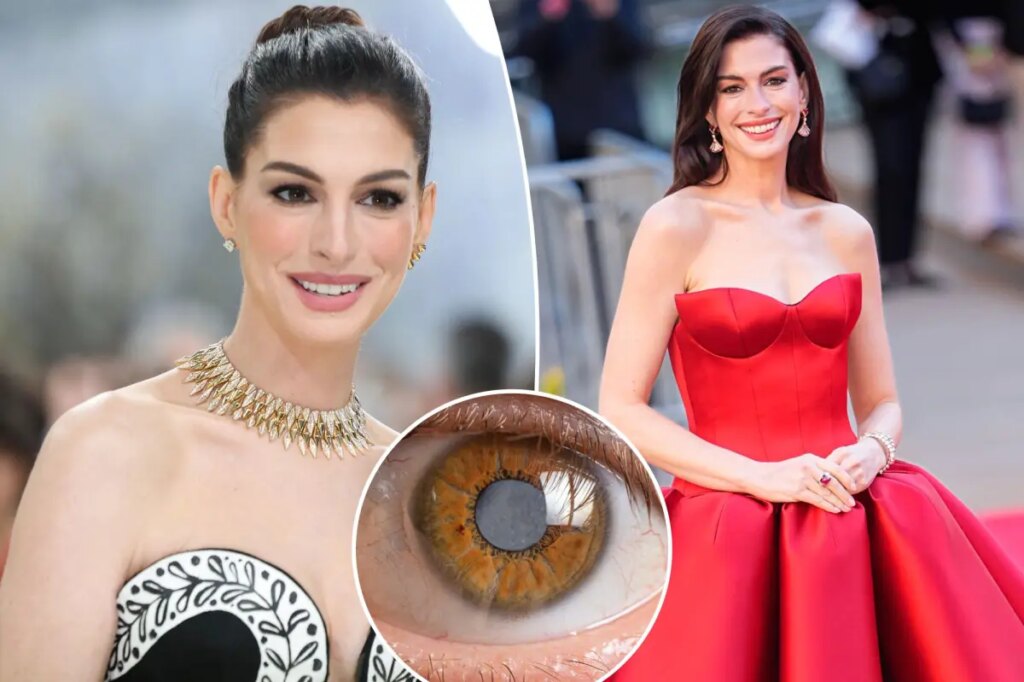Anne Hathaway’s secret decade-long medical condition left her nearly blind throughout her 30s