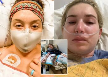 The unpredictable disease attacking women 5 times more than men — doctors only study it for ‘one minute’