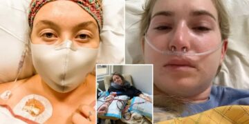 The unpredictable disease attacking women 5 times more than men — doctors only study it for ‘one minute’