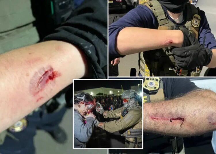 Anti-ICE agitator charged with allegedly biting officers during Delaney Hall protest