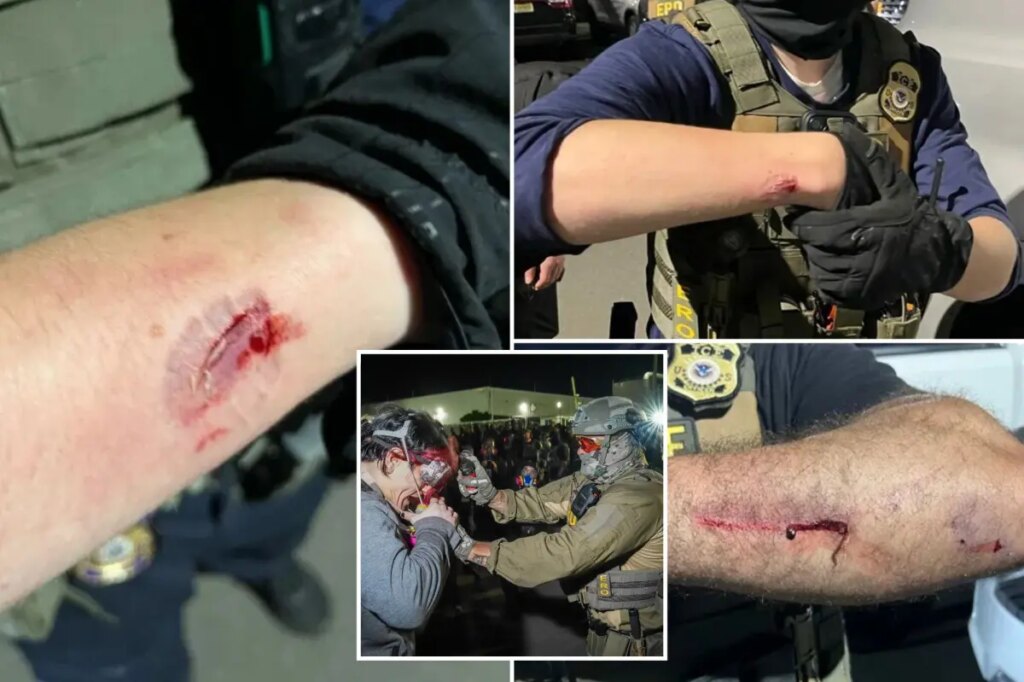 Anti-ICE agitator charged with allegedly biting officers during Delaney Hall protest