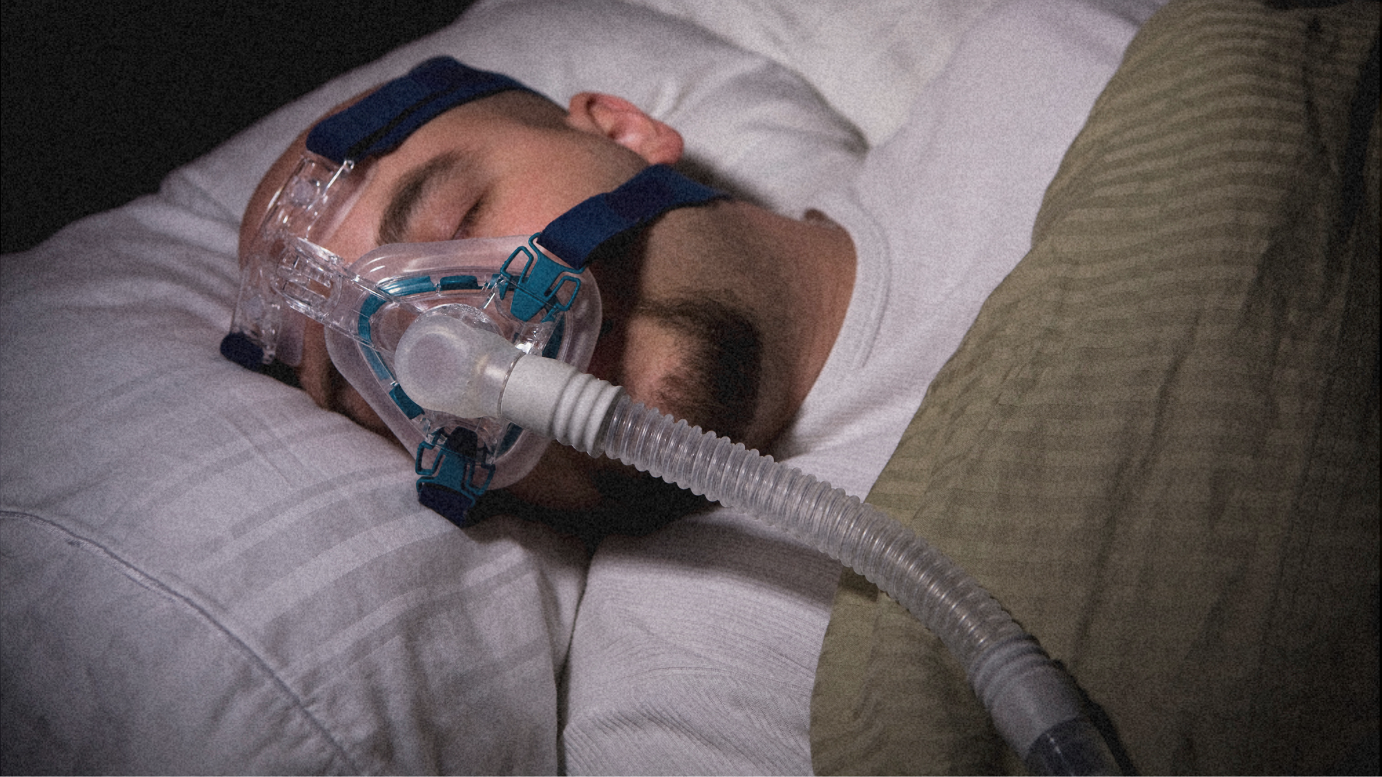 Snorers Rejoice! There May Soon Be a Sleep Apnea Remedy That Doesn’t Involve Strapping a CPAP to Your Face