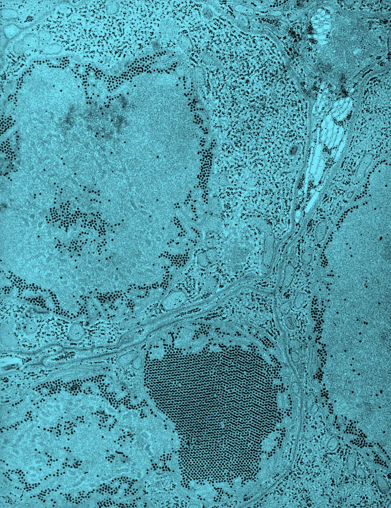 Transmission electron microscope image of St. Louis Encephalitis (SLE) virus in the salivary gland of a mosquito.