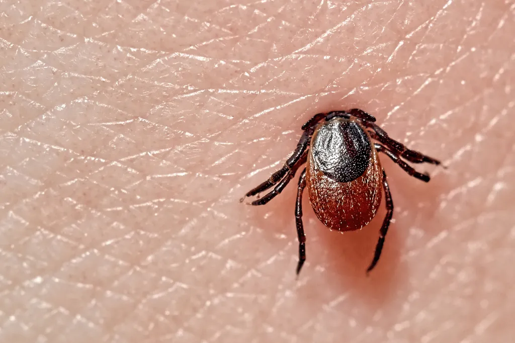 Close-up photo of a black and reddish-brown Ixodes ricinus tick attached to human skin.