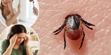 Meat allergies, confusion, vomiting — 5 diseases you can get from ticks as ER visits spike