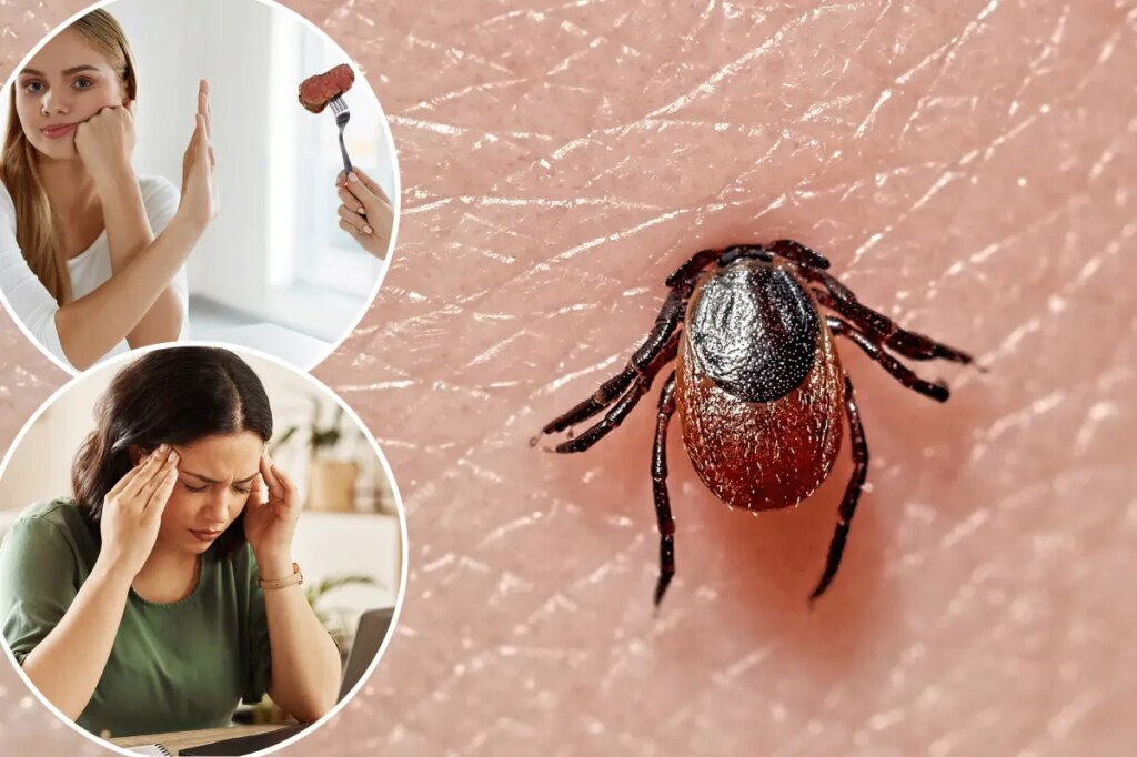 Meat allergies, confusion, vomiting — 5 diseases you can get from ticks as ER visits spike