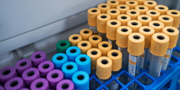 Scientists Are Getting Closer to a Blood Test for Lung Cancer