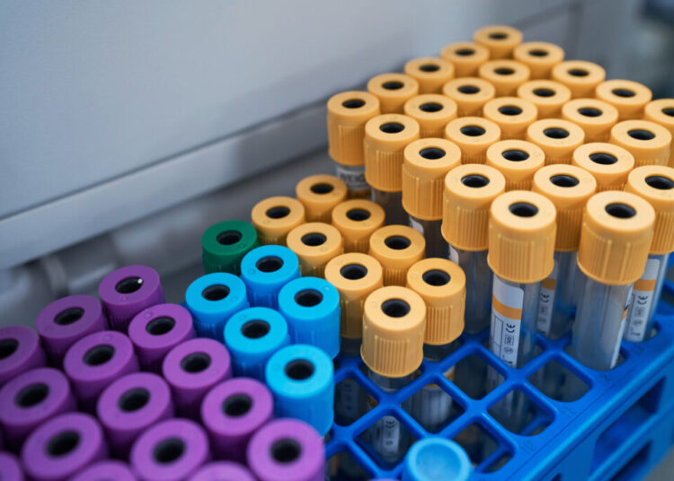 Scientists Are Getting Closer to a Blood Test for Lung Cancer