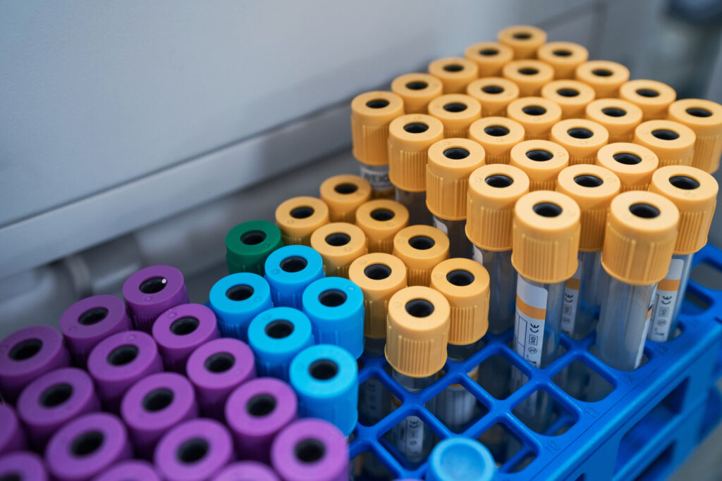Scientists Are Getting Closer to a Blood Test for Lung Cancer