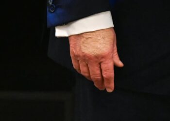 Observers point out Trump’s bruised hands during his health care affordability event