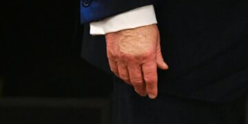 Observers point out Trump’s bruised hands during his health care affordability event