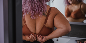 ‘Uniboob’ Is an Actual Medical Condition. Here’s How It Happens.