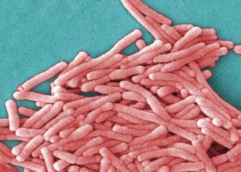 19 Legionella bacteria infections linked to Kaiser Bay Area hospital