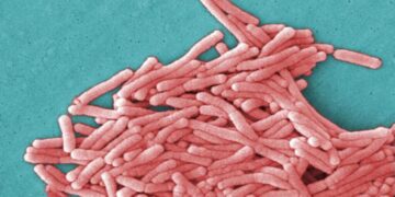 19 Legionella bacteria infections linked to Kaiser Bay Area hospital