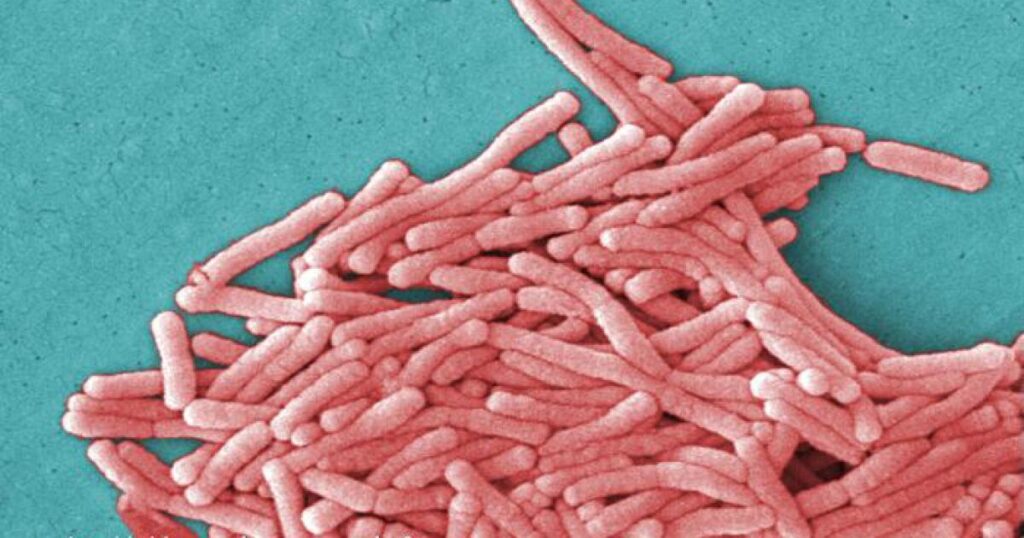 19 Legionella bacteria infections linked to Kaiser Bay Area hospital