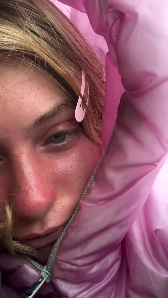Kamryn Renae wearing a pink puffer jacket and a pink hair clip, with a sunburned face.