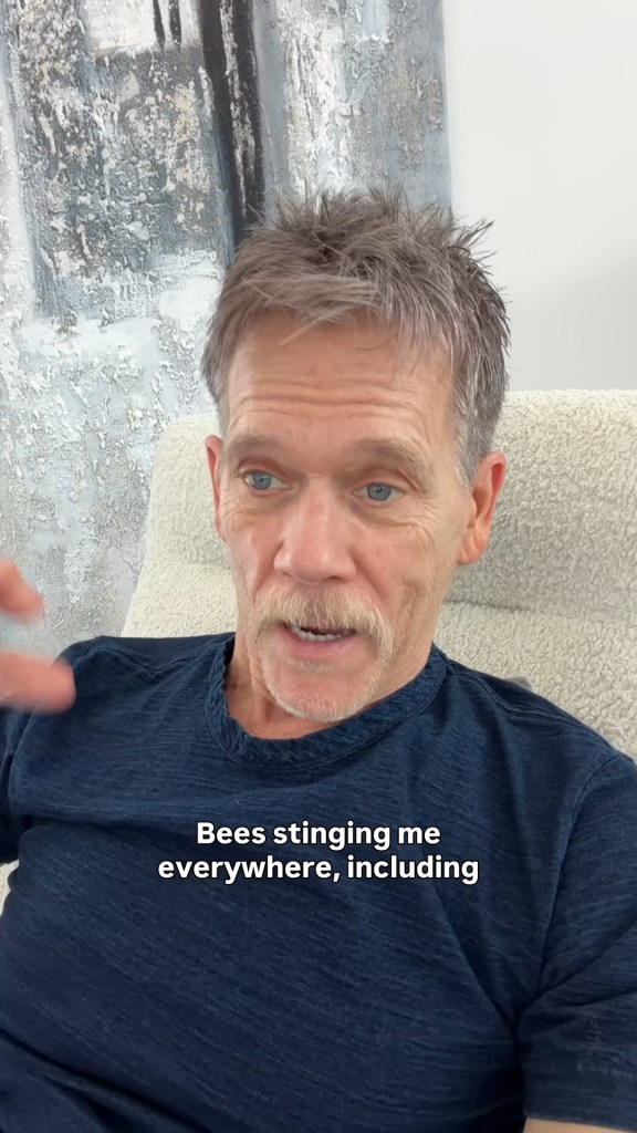Kevin Bacon describing being stung by bees.