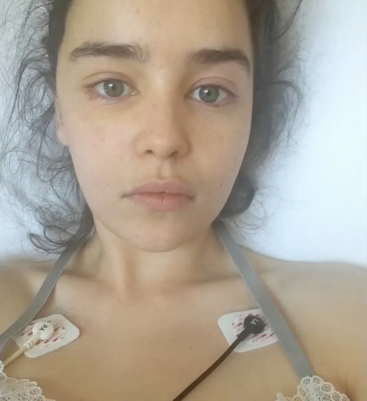 Emilia Clarke in a hospital bed with electrodes on her chest.