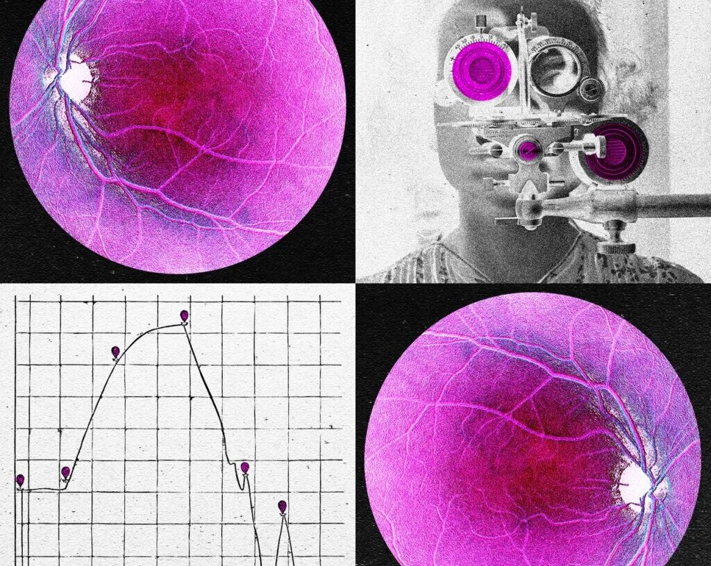Longevity Startup Doses First Human in Bid to Reverse Age-Related Sight Loss