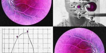 Longevity Startup Doses First Human in Bid to Reverse Age-Related Sight Loss