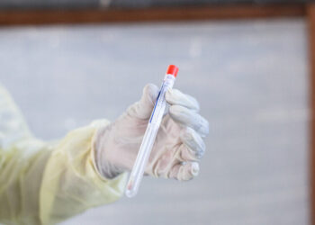 Dutch Scientist Charged With Conspiring to Smuggle Mpox Virus Into U.S.