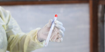 Dutch Scientist Charged With Conspiring to Smuggle Mpox Virus Into U.S.