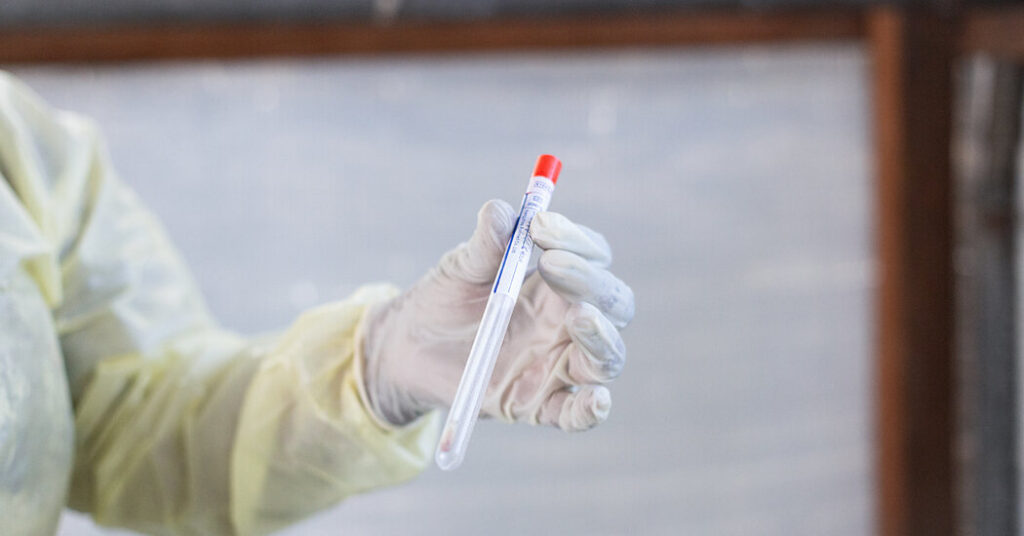 Dutch Scientist Charged With Conspiring to Smuggle Mpox Virus Into U.S.