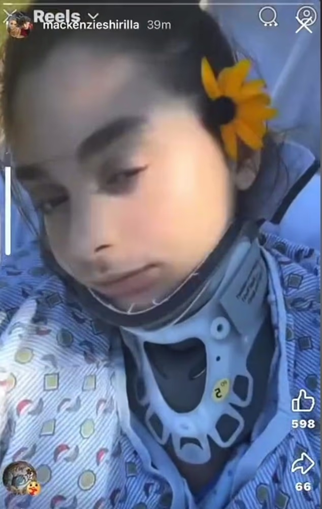 A woman with a neck brace wearing a flower in her hair.