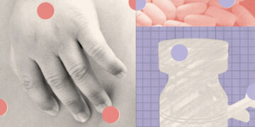 With Measles Roaring Back, the Search for a Treatment is On