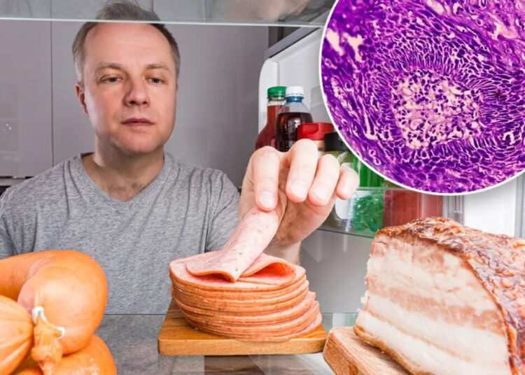 One extra serving of processed meat a day linked to higher cancer risk