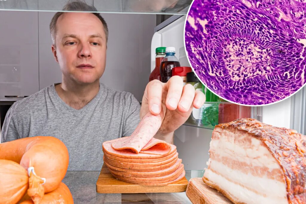 One extra serving of processed meat a day linked to higher cancer risk