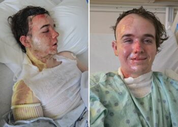 McDonald’s employee in ICU after coworker allegedly threw hot oil on him: ‘Why would he do this to me?’
