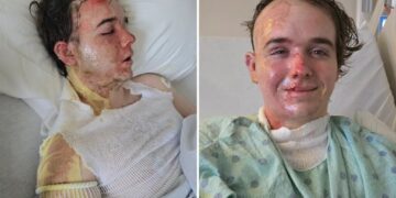 McDonald’s employee in ICU after coworker allegedly threw hot oil on him: ‘Why would he do this to me?’