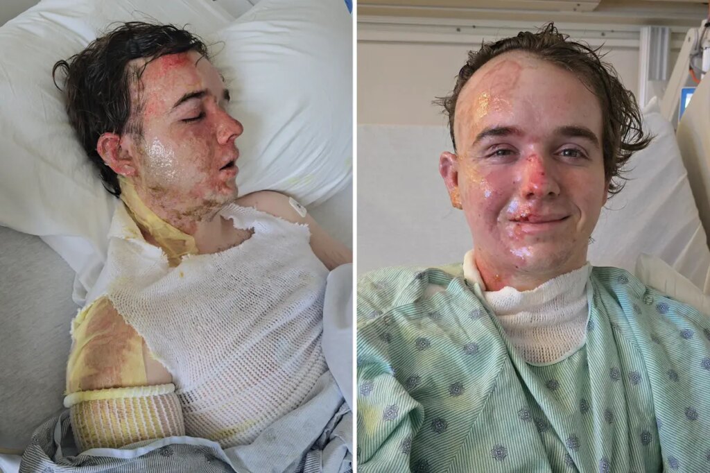 McDonald’s employee in ICU after coworker allegedly threw hot oil on him: ‘Why would he do this to me?’
